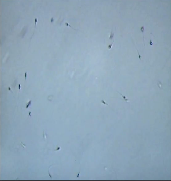 出色的IMSI，精子慢流形态学筛选胞浆内单精子注射技术