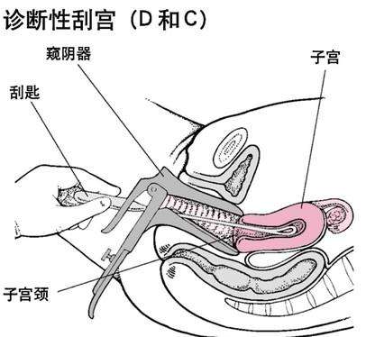 高龄女性欲生二胎屡遭胎停 在坤和成功圆梦