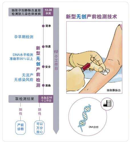 无创产前基因检测查染色体异常