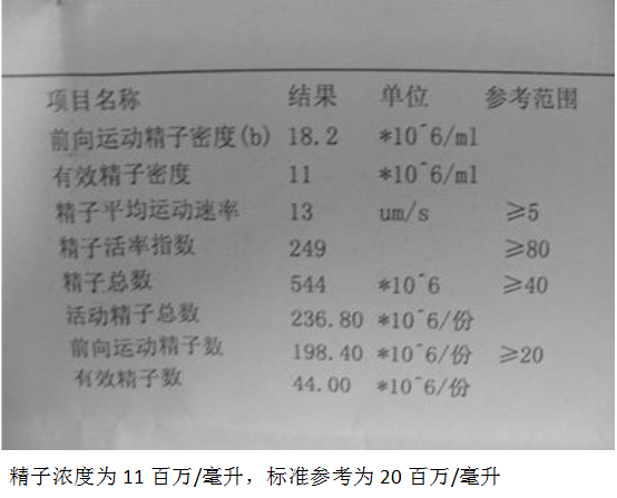 男性少精报告单